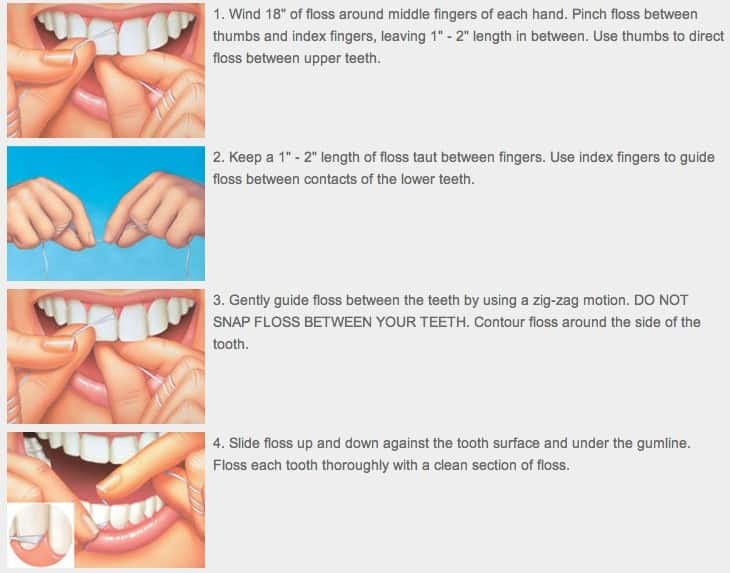 filosofisk Stat Precipice Your Dental Flossing Questions Answered - Family Dentist Tree Rochester MN